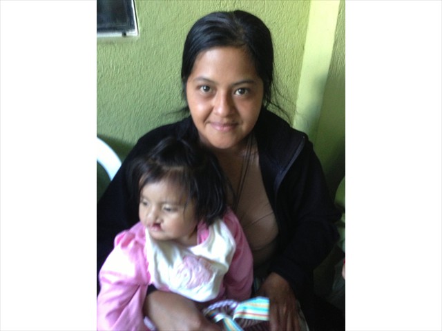 Mother and precious child waiting for her surgery for her cleft lip at Metropolitan Hospital, Guatemala.