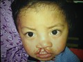 I want to thrive and live like others kid in our world. Can you help?