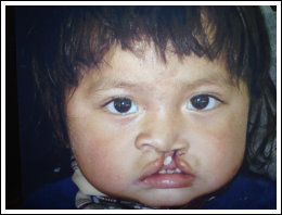 Little Girl Needing Surgery